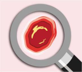 Pressure Ulcer Prevention & Intervention Service