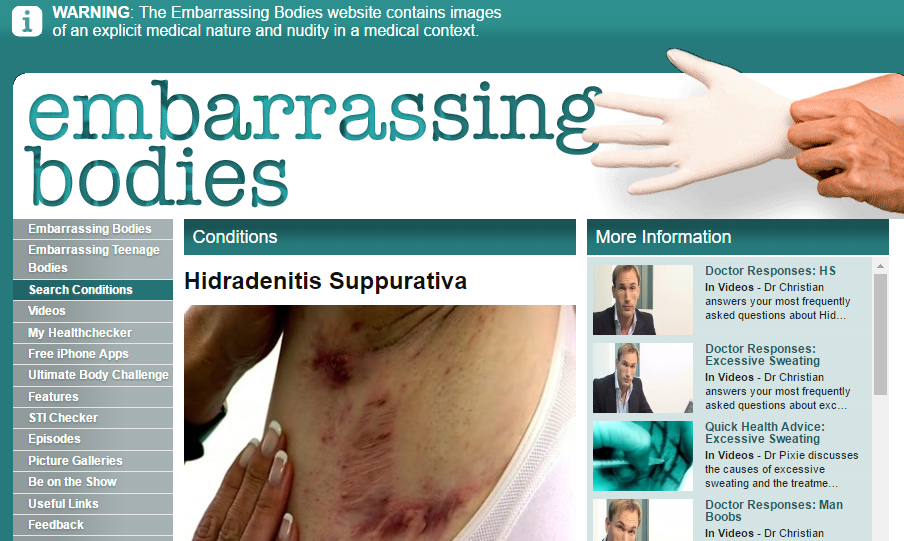Embarrassing bodies